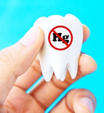 Amalgama dentale: da usare ma senza esagerare, lo dice la CEE